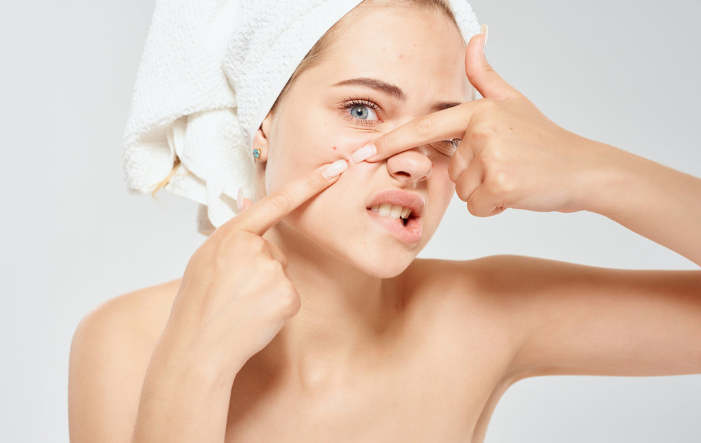 Causes of Adult Acne and Ways to Prevent or Get Rid of It.