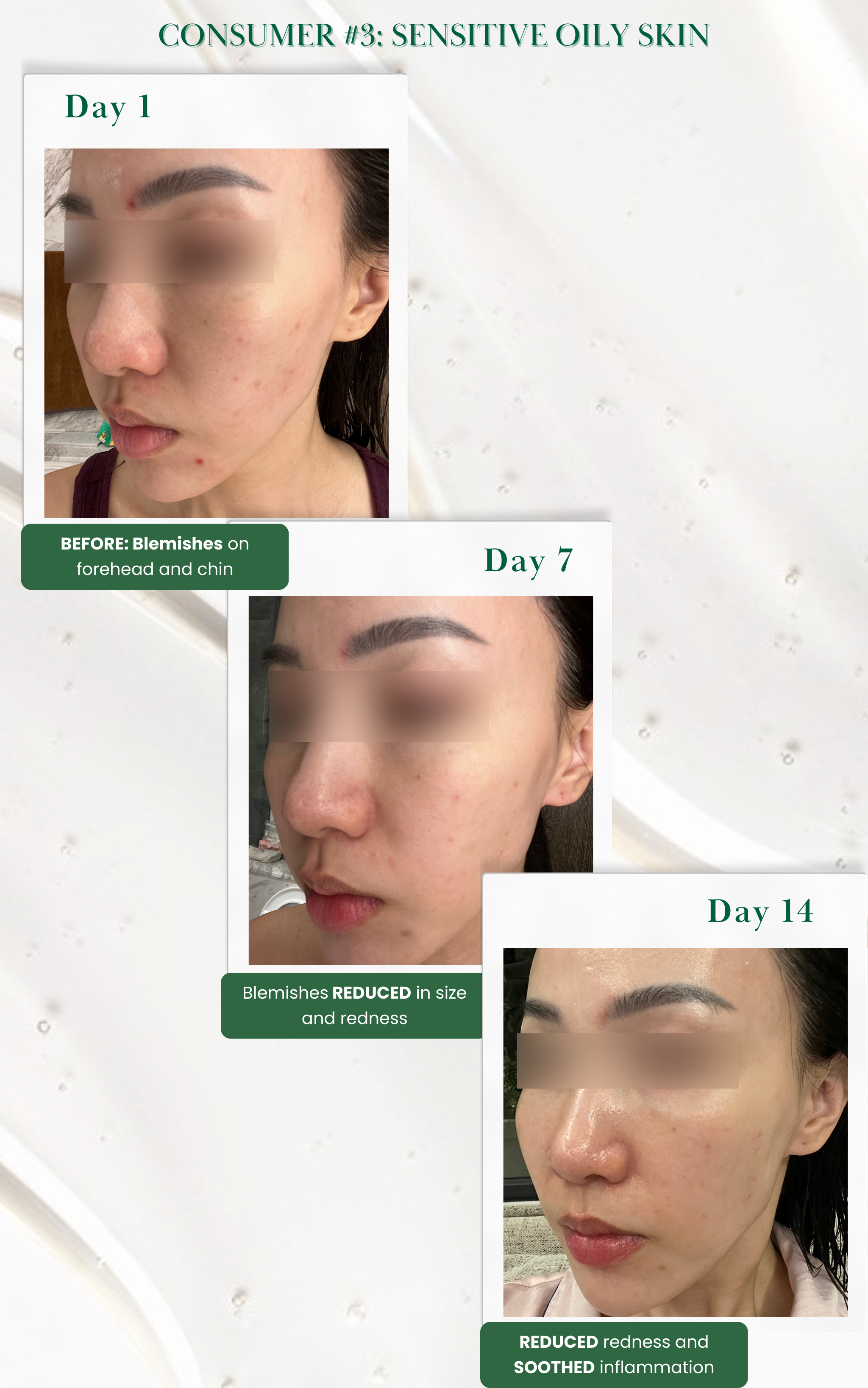 Skin Renewal Kit