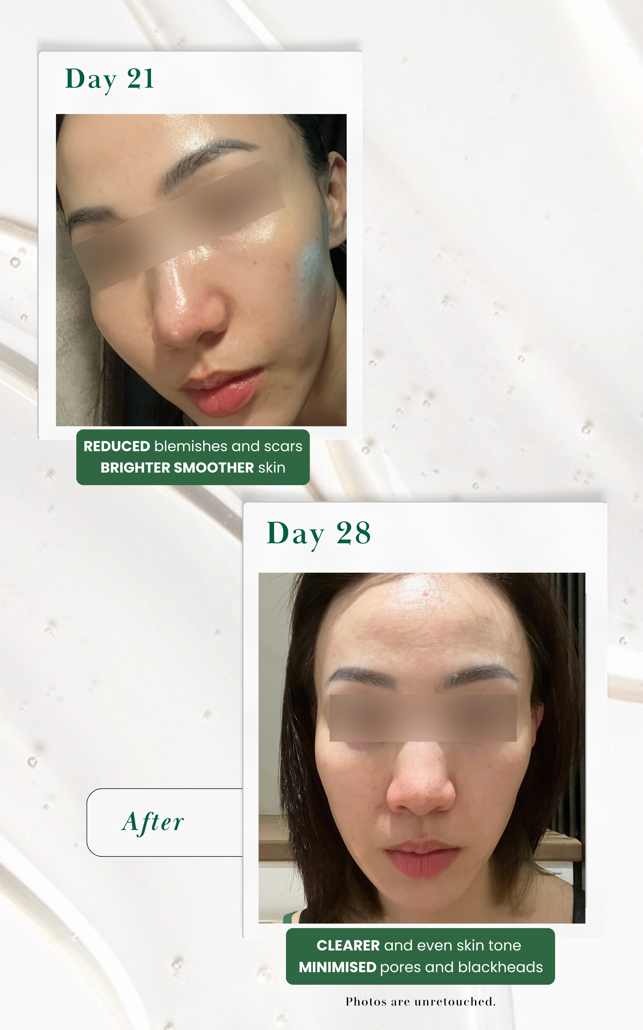 Skin Renewal Kit