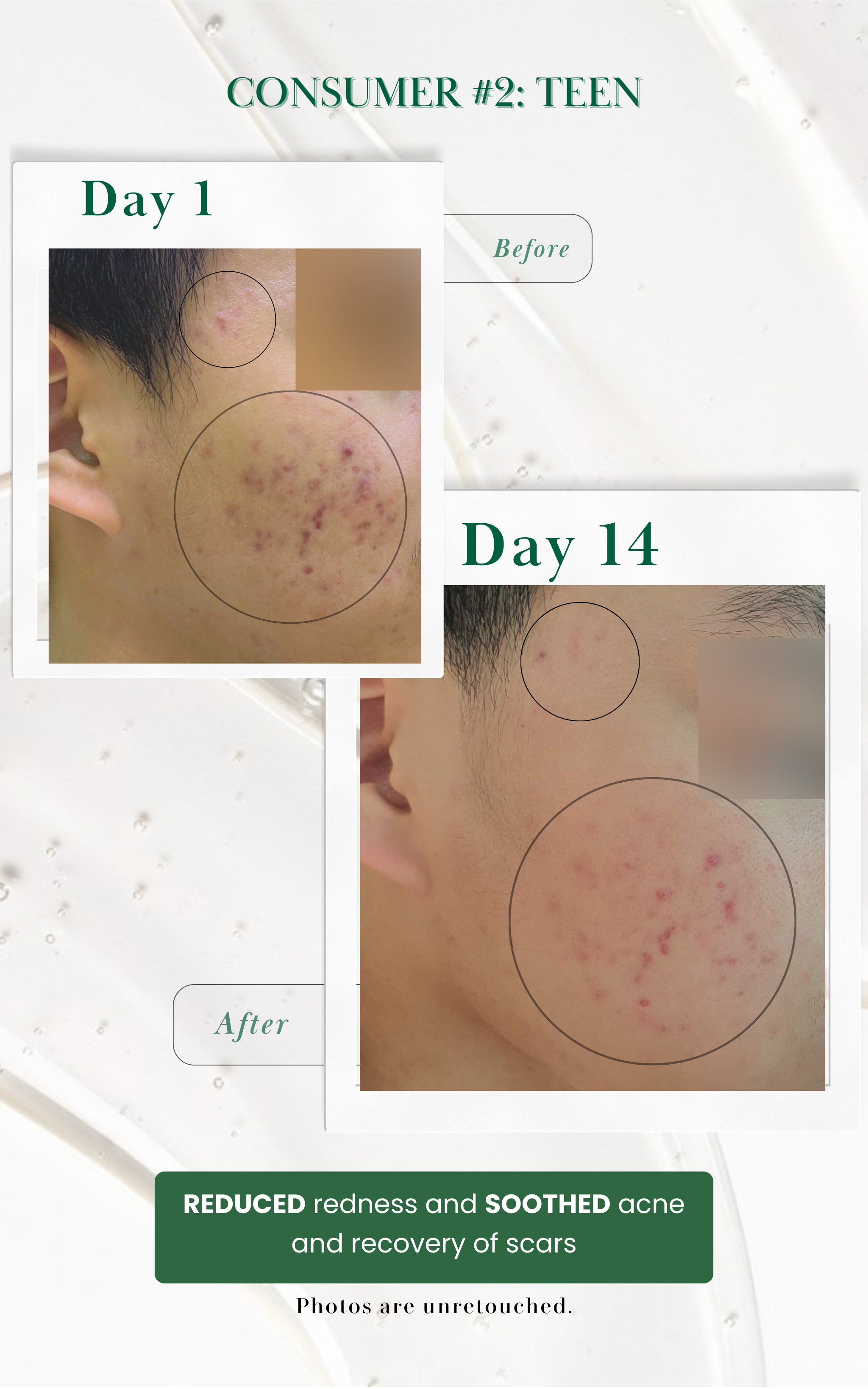 Skin Renewal Kit